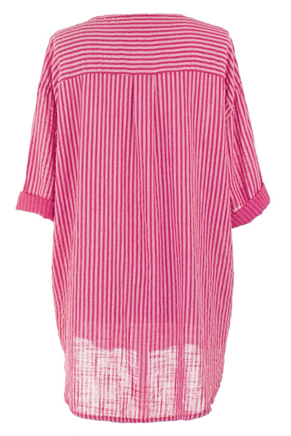 Stripe Button Detail Top